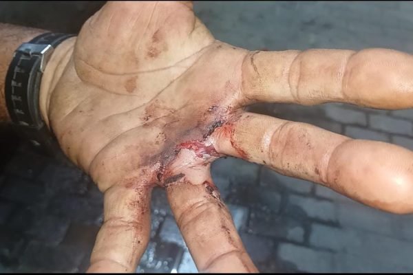 WhatsApp Image 2026-03-01 at 7.53.03 PM